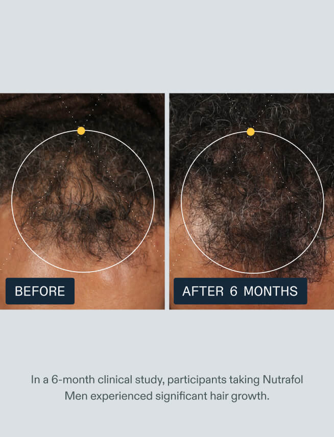 Men's Hair Growth Nutraceutical - product image 3