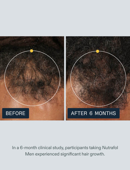 Men's Hair Growth Nutraceutical - product image 3