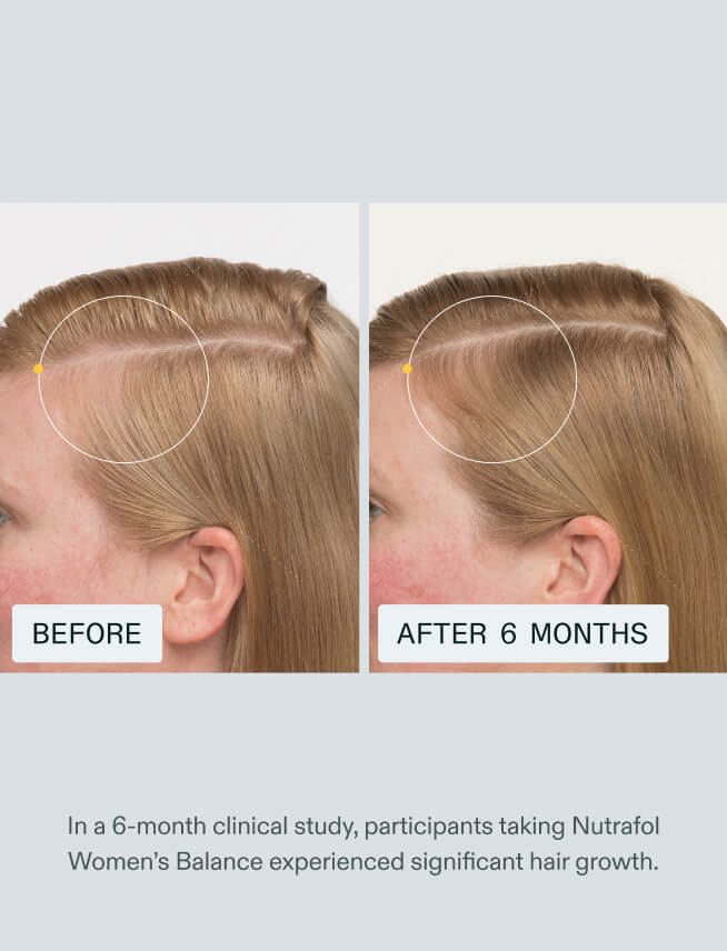 Women's Balance Hair Growth Nutraceutical - product image 4