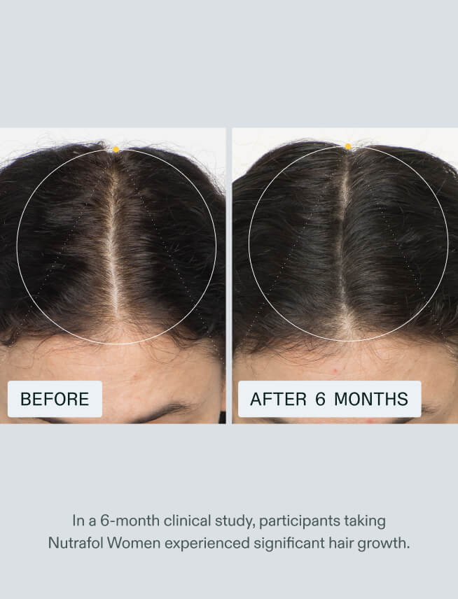 Women's Hair Growth Nutraceutical - product image 4